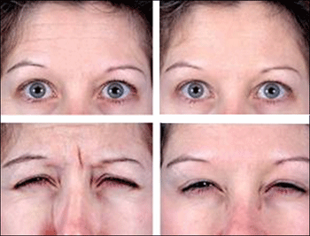 surgical images