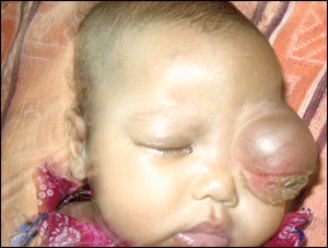 surgical images