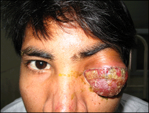 surgical images